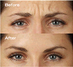 Before & After Photos